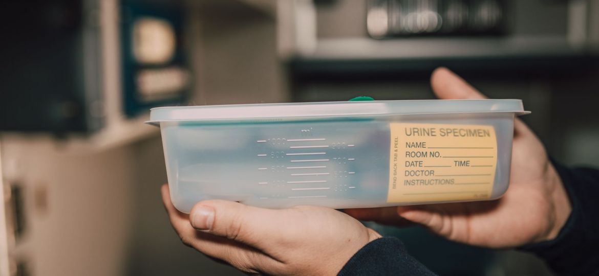 Recipiente para muestra de orina en un análisis veterinario